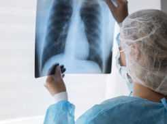 В феврале в сёла Таловского района приедет передвижной флюорограф