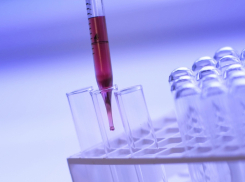 В Воронежской области сибирскую язву заподозрили у 15-летнего мальчика