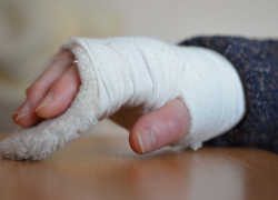 35 жителей Воронежской области попали в больницу из-за обморожения