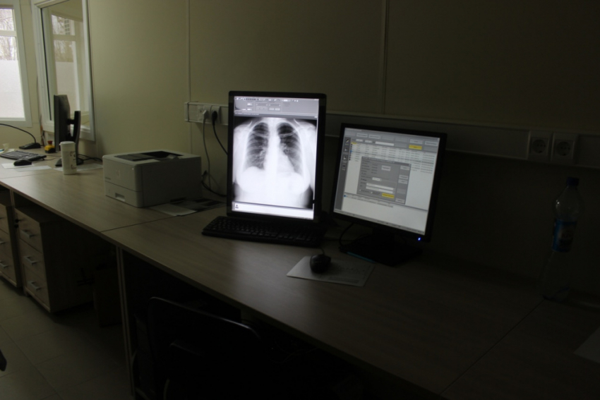 В феврале в сёла Таловского района приедет передвижной флюорограф